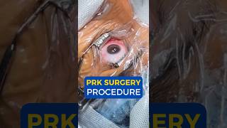 What is PRK Surgery I PRK Surgery Procedure [upl. by Uzzia672]