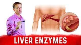 High Liver Enzymes ALT amp AST – What Do They Mean – DrBerg [upl. by Namus617]