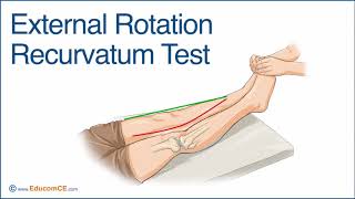 External Rotation Recurvatum Test [upl. by Bakki]