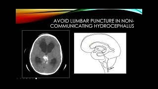 Cerebrospinal fluid [upl. by Yetsirhc]