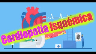 Cardiopatía Isquémica PRIMERA PARTE [upl. by Larianna]