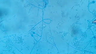 Penicillium growth and its structures under the microscope [upl. by Zelikow]