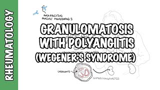 Granulomatosis with Polyangiitis pathophysiology symptoms treatment [upl. by Einuj222]