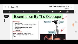 Clinical examination ear and nose [upl. by Suiddaht]