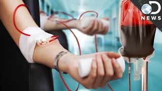 How Do Blood Transfusions Work [upl. by Bail126]