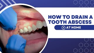 How To Drain A Tooth Abscess At Home Using Home Remedies [upl. by Buddie]