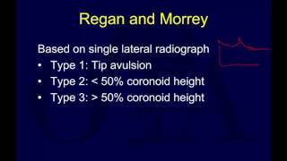 Traumatic elbow instability  terrible triad OTA lecture series IV u06b [upl. by Ardried]