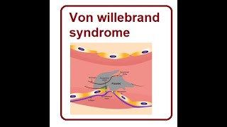 Von Willebrand Disease  2024 [upl. by Yelnikcm]