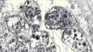 Toxoplasmosis amp Toxoplasma gondii [upl. by Olds]