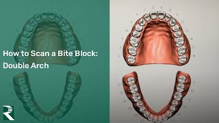 How to Scan a Bite Block double arch [upl. by Anurag]