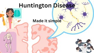 Huntington disease  symptoms MRI findings and treatment [upl. by Reginnej]