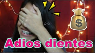 Extraccion de Premolares mi experiencia con brakets Duele [upl. by Ennayllek]