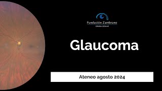 Fundacion Zambrano Ateneo Glaucoma [upl. by Parette]