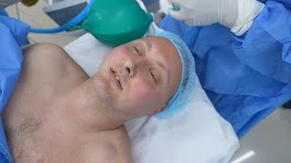 American Man going under Anesthesia Cosmetic Surgery [upl. by Sorel]