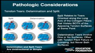 Shoulder Rotator Cuff  Part I Exploring the Rotator Cuff Anatomy Microscopic and Macroscopic Level [upl. by Nakada]