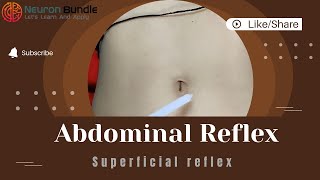 Mastering Superficial Abdominal reflex  Normal amp Absent reflex umnlesion reflexes [upl. by Renelle]