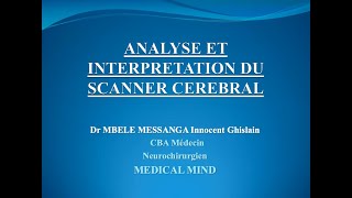 Comment gérer les céphalées et migraines liées à la sclérose en plaques SEP [upl. by Jack]