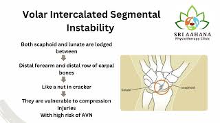 VISI  Volar Intercalated Segmental Instability [upl. by Airotna]