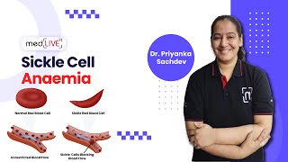 Sickle Cell Anaemia  Pathogenesis  Factors  Diagnosis by DR Priyanka Sachdev  MedLive [upl. by Cantlon]