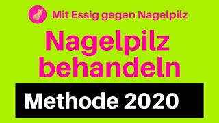 Nagelpilz Behandlung Essig gegen Nagelpilz 2020 entfernen loswerden [upl. by Lockwood82]