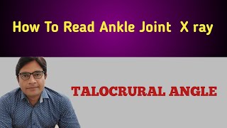 How To Measure TALOCRURAL ANGLE On Ankle X ray [upl. by Ciardap744]