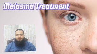 Chemical Peels HyperpigmentationMelasma of Face Dr Faisal Mansoor [upl. by Nylqcaj]