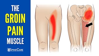 The Groin Pain Muscle How to Release It for INSTANT RELIEF [upl. by Ielhsa]