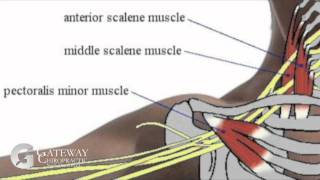 Gateway Minute Thoracic Outlet Syndrome TOS [upl. by Akerdal963]