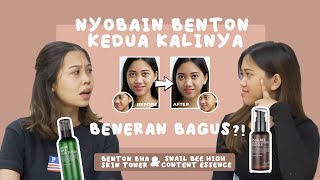 SKIREVIEW Nyobain ALOE BHA SKIN TONER dan SNAIL BEE HIGH CONTENT ESSENCE [upl. by Bael697]