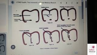 FCPS 1 CVS EMBRYOLOGY lecture 1 cardiac looping atrial septation [upl. by Avlasor469]