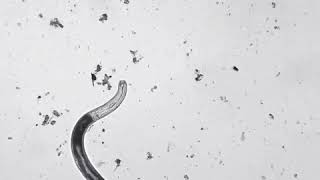 Soil Nematodes [upl. by Rad]