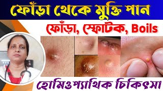 Fora Treatment Bangla  ফোঁড়া চিকিৎসা  Best Medicine For Boils  Homeopathy Medicine For Fora [upl. by Atteselrahc618]