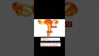 Understanding the uterus बच्चेदानी कैसी होती है  Dr Shrutis corner  Youtube shorts [upl. by Norramic]