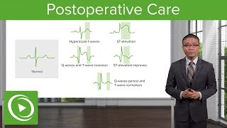 Postoperative Care – Surgery  Lecturio [upl. by Attegroeg]