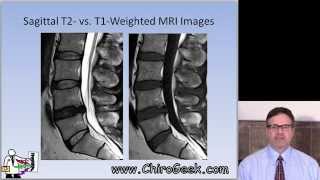 Dr Gillard lectures on How to Read Your Lumbar MRI [upl. by Adamsun]