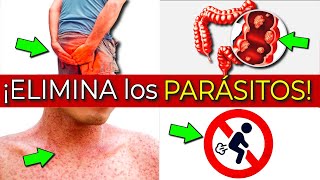 Consecuencias en tu cuerpo de tener parásitos y qué es bueno para eliminarlos [upl. by Eniger440]