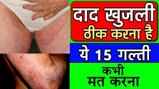 fungal infection in private parts  fungal infection treatment  fungal infection on skin [upl. by Marci]