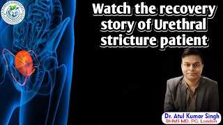 best Homeopathic treatment for urethral stricture [upl. by Averi523]