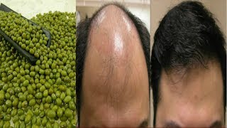 Hair Regrowth  Prevent Hair Thinning  Hair Fall 100 Natural Hair Loss Treatment  Priya Malik [upl. by Llehcor]