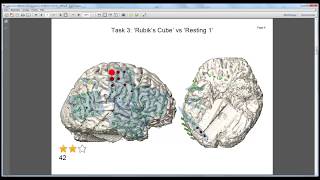 cortiQ  rapid cortical mapping extended [upl. by Vinay925]