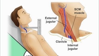 Jugular Venous Distention Explained clearly PART A Jugular venous pressure Waveform [upl. by Strephonn]