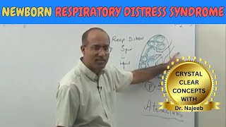 Newborn Respiratory Distress Syndrome  Pathophysiology🫁 [upl. by Chlo]