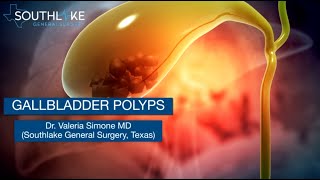 Gallbladder Polyps – Causes Symptoms amp Treatment [upl. by Rehpotirhc]