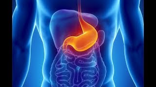 What is Dyspepsia What causes Dyspepsia Symptoms and Treatment of Indigestion [upl. by Hebel899]