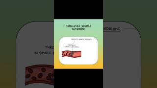 Hemolytic Uremic Syndrome shortsvideo nclex nursingexam youtubeshorts nclexexam [upl. by Karly]