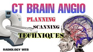 ct brain angio procedure planing technique full video [upl. by Klayman]