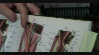 ilioinguinal iliohypogastric and genitofemoral nerve eval 5 of 5 Jerry Hesch [upl. by Grissom845]