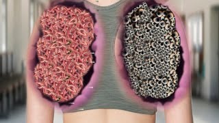 ASMR Back Treatment Animation  ASMR Maggots Removal for Ultimate Relaxation sleep ASMR [upl. by Iznyl601]