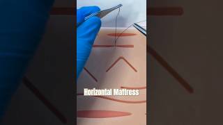 The Horizontal Mattress Suture suturing sutures horizontalmattress stitch wound urgentcare [upl. by Akenor462]