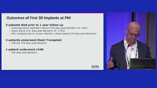 ISHLT 2023 Piedmont Heart Institute Experience with Barostim by Dr Robert T Cole [upl. by Isiad]